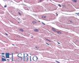 STRADB / ALS2CR2 Antibody - Anti-STRADB antibody IHC of human heart. Immunohistochemistry of formalin-fixed, paraffin-embedded tissue after heat-induced antigen retrieval. Antibody concentration 75 ug/ml.