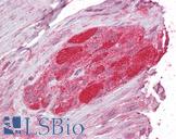 STUB1 / CHIP Antibody - Anti-STUB1 antibody IHC of human small intestine, myenteric plexus. Immunohistochemistry of formalin-fixed, paraffin-embedded tissue after heat-induced antigen retrieval. Antibody concentration 2.5 ug/ml.