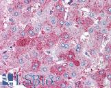 SUPT16H / FACTP140 Antibody - Anti-SUPT16H antibody IHC of human liver. Immunohistochemistry of formalin-fixed, paraffin-embedded tissue after heat-induced antigen retrieval. Antibody concentration 10 ug/ml.