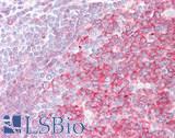 SWAP70 Antibody - Human Tonsil: Formalin-Fixed, Paraffin-Embedded (FFPE)