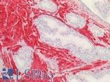 TAGLN / Transgelin / SM22 Antibody - Human Prostate: Formalin-Fixed, Paraffin-Embedded (FFPE)