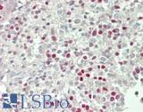TBX21 / T-bet Antibody - Human Spleen: Formalin-Fixed, Paraffin-Embedded (FFPE)