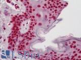 TCEB3 / Elongin A Antibody - Human Skin: Formalin-Fixed, Paraffin-Embedded (FFPE)