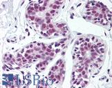 TDP-43 / TARDBP Antibody - Anti-TARDBP antibody IHC of human breast. Immunohistochemistry of formalin-fixed, paraffin-embedded tissue after heat-induced antigen retrieval. Antibody concentration 5 ug/ml.