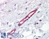 TEM7 Antibody - Anti-TEM7 antibody IHC of human breast, vessels. Immunohistochemistry of formalin-fixed, paraffin-embedded tissue after heat-induced antigen retrieval. Antibody concentration 5 ug/ml.