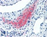 TGFB4 / LEFTY2 Antibody - Anti-LEFTY2 antibody IHC of human uterus, myometrium. Immunohistochemistry of formalin-fixed, paraffin-embedded tissue after heat-induced antigen retrieval. Antibody concentration 10 ug/ml.
