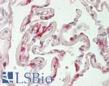 THBD / CD141 / Thrombomodulin Antibody - Human Lung: Formalin-Fixed, Paraffin-Embedded (FFPE)
