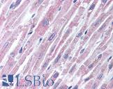 TLR2 Antibody - Anti-TLR2 antibody IHC of human heart. Immunohistochemistry of formalin-fixed, paraffin-embedded tissue after heat-induced antigen retrieval. Antibody concentration 2 ug/ml.