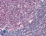 TLR4 Antibody - Anti-TLR4 antibody IHC of human tonsil. Immunohistochemistry of formalin-fixed, paraffin-embedded tissue after heat-induced antigen retrieval. Antibody concentration 5 ug/ml.