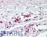 TLR5 Antibody - Anti-TLR5 antibody IHC of human lung, alveolar macrophages. Immunohistochemistry of formalin-fixed, paraffin-embedded tissue after heat-induced antigen retrieval. Antibody concentration 5 ug/ml.