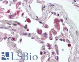 TLR9 Antibody - Anti-TLR9 antibody IHC of human lung. Immunohistochemistry of formalin-fixed, paraffin-embedded tissue after heat-induced antigen retrieval. Antibody concentration 5 ug/ml.