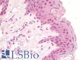 TLX1 / HOX11 Antibody - Anti-TLX1 / HOX11 antibody IHC staining of human skin. Immunohistochemistry of formalin-fixed, paraffin-embedded tissue after heat-induced antigen retrieval. Antibody concentration 10 ug/ml.