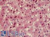 TMPO / TP / Thymopoietin Antibody - Anti-TMPO / TP / Thymopoietin antibody IHC staining of human liver. Immunohistochemistry of formalin-fixed, paraffin-embedded tissue after heat-induced antigen retrieval. Antibody concentration 2.5 ug/ml.