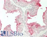 TMPRSS2 / Epitheliasin Antibody - Human Prostate: Formalin-Fixed, Paraffin-Embedded (FFPE)