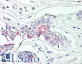 TNFAIP8 / SCC-S2 Antibody - Anti-SCC-S2 / TNFAIP8 antibody IHC of human breast. Immunohistochemistry of formalin-fixed, paraffin-embedded tissue after heat-induced antigen retrieval. Antibody dilution 5 ug/ml.