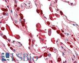 TNFSF13 / APRIL Antibody - Anti-APRIL antibody IHC of human lung. Immunohistochemistry of formalin-fixed, paraffin-embedded tissue after heat-induced antigen retrieval. Antibody concentration 5 ug/ml.