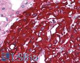 TOLLIP Antibody - Anti-TOLLIP antibody IHC of human adrenal. Immunohistochemistry of formalin-fixed, paraffin-embedded tissue after heat-induced antigen retrieval. Antibody concentration 5 ug/ml.