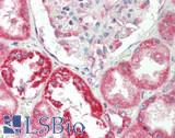 TOMM20 Antibody - Human Kidney: Formalin-Fixed, Paraffin-Embedded (FFPE)