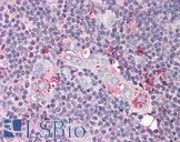 TP53AIP1 / p53 AIP1 Antibody - Anti-TP53AIP1 / p53AIP1 antibody IHC of human thymus. Immunohistochemistry of formalin-fixed, paraffin-embedded tissue after heat-induced antigen retrieval. Antibody concentration 5 ug/ml.
