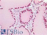 TP53BP1 / 53BP1 Antibody - Human Thyroid: Formalin-Fixed, Paraffin-Embedded (FFPE)