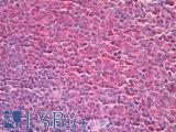 TPT1 / TCTP Antibody - Human Spleen: Formalin-Fixed, Paraffin-Embedded (FFPE)