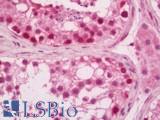 TRB3 / TRIB3 Antibody - Human Testis: Formalin-Fixed, Paraffin-Embedded (FFPE)