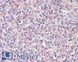 TRIB1 Antibody - Anti-TRIB1 antibody IHC of human spleen. Immunohistochemistry of formalin-fixed, paraffin-embedded tissue after heat-induced antigen retrieval. Antibody concentration 3.75 ug/ml.