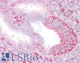 TRIM39 / RNF23 Antibody - Anti-TRIM39 / RNF23 antibody IHC of human uterus. Immunohistochemistry of formalin-fixed, paraffin-embedded tissue after heat-induced antigen retrieval. Antibody concentration 3.75 ug/ml.