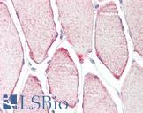 TRIM54 / MURF Antibody - Anti-TRIM54 / MURF antibody IHC staining of human skeletal muscle. Immunohistochemistry of formalin-fixed, paraffin-embedded tissue after heat-induced antigen retrieval.