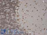 TRPM7 Antibody - IHC analysis of TrpM7 tested on mouse brain using a dilution of TRPM7 antibody. Strong positivity of the nuclear membrane of every cell.  This image was taken for the unconjugated form of this product. Other forms have not been tested.