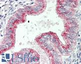 TSPAN1 / TM4SF Antibody - Human Uterus: Formalin-Fixed, Paraffin-Embedded (FFPE)
