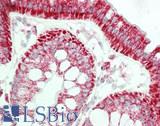 TSPO / PBR Antibody - Human Colon: Formalin-Fixed, Paraffin-Embedded (FFPE)