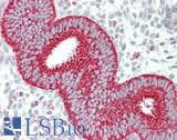 TSPO / PBR Antibody - Human Uterus: Formalin-Fixed, Paraffin-Embedded (FFPE)