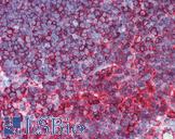 TUBB / Beta Tubulin Antibody - Anti-TUBB / Tubulin, Beta antibody IHC of human thymus. Immunohistochemistry of formalin-fixed, paraffin-embedded tissue after heat-induced antigen retrieval. Antibody dilution 1:100. This image was taken for the unconjugated form of this product. Other forms have not been tested.