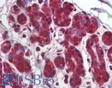 Tubulin Gamma Antibody - Human Breast: Formalin-Fixed, Paraffin-Embedded (FFPE)