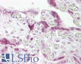 TWIST1 / TWIST Antibody - Anti-TWIST1 / TWIST antibody IHC of human placenta. Immunohistochemistry of formalin-fixed, paraffin-embedded tissue after heat-induced antigen retrieval. Antibody concentration 10 ug/ml.