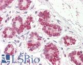 UBASH3A / CLIP4 Antibody - Anti-UBASH3A antibody IHC of human breast. Immunohistochemistry of formalin-fixed, paraffin-embedded tissue after heat-induced antigen retrieval. Antibody dilution 3.75 ug/ml.