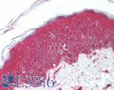 UBE2N / UBC13 Antibody - Anti-UBE2N antibody IHC of human skin. Immunohistochemistry of formalin-fixed, paraffin-embedded tissue after heat-induced antigen retrieval. Antibody concentration 5 ug/ml.