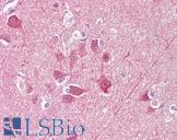 UCHL1 / PGP9.5 Antibody - Anti-UCHL1 / PGP9.5 antibody IHC of human brain, cortex. Immunohistochemistry of formalin-fixed, paraffin-embedded tissue after heat-induced antigen retrieval. Antibody concentration 10 ug/ml.