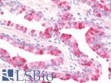 USP51 Antibody - Anti-USP51 antibody IHC staining of human prostate. Immunohistochemistry of formalin-fixed, paraffin-embedded tissue after heat-induced antigen retrieval.