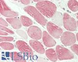 USP53 Antibody - Human Tonsil, Myocytes: Formalin-Fixed, Paraffin-Embedded (FFPE)