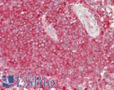 USP6NL Antibody - Human Spleen: Formalin-Fixed, Paraffin-Embedded (FFPE)