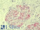 Vasohibin 1 / VASH1 Antibody - Anti-Vasohibin 1 / VASH1 antibody IHC staining of human prostate, ganglion. Immunohistochemistry of formalin-fixed, paraffin-embedded tissue after heat-induced antigen retrieval.
