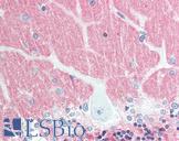 VILIP / VSNL1 Antibody - Anti-VILIP / VSNL1 antibody IHC staining of human brain, cerebellum. Immunohistochemistry of formalin-fixed, paraffin-embedded tissue after heat-induced antigen retrieval. Antibody concentration 10 ug/ml.