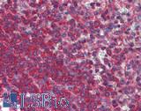 VIPERIN / RSAD2 Antibody - Human Spleen: Formalin-Fixed, Paraffin-Embedded (FFPE)