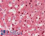 VSIR / GI24 / VISTA Antibody - Human Liver: Formalin-Fixed, Paraffin-Embedded (FFPE)