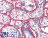 VSIR / GI24 / VISTA Antibody - Human Placenta: Formalin-Fixed, Paraffin-Embedded (FFPE) at 10 µg/ml.