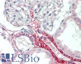 WNK1 Antibody - Human Kidney: Formalin-Fixed, Paraffin-Embedded (FFPE), at a dilution of 1:100.