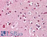 XAB2 Antibody - Anti-XAB2 / HCNP antibody IHC of human brain, cortex. Immunohistochemistry of formalin-fixed, paraffin-embedded tissue after heat-induced antigen retrieval. Antibody dilution 3.75 ug/ml.