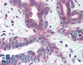 XBP1 Antibody - Anti-XBP1 antibody IHC of human breast. Immunohistochemistry of formalin-fixed, paraffin-embedded tissue after heat-induced antigen retrieval. Antibody concentration 5 ug/ml.